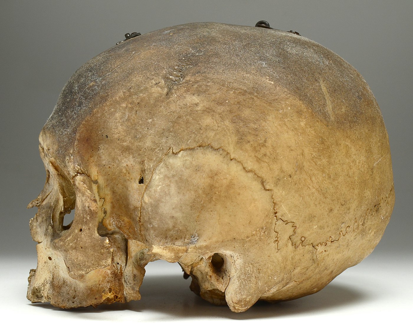 Authentic Human Skull With Hinged Opening Ebth